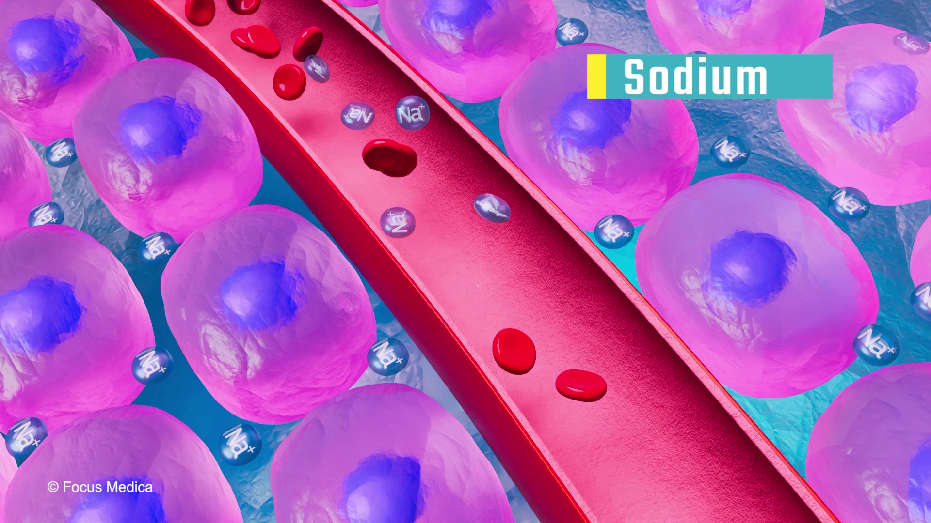 Electrolyte Imbalancesy