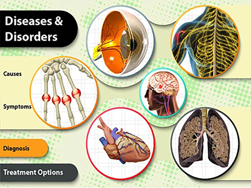 Understanding Diseases