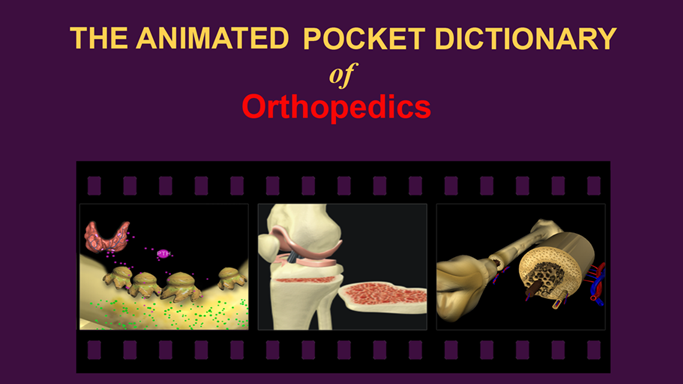 Orthopedics