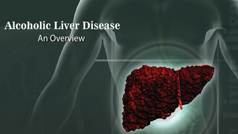 Alcoholic Liver Disease