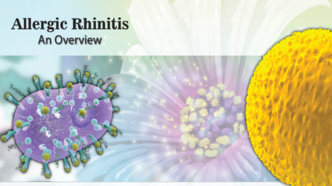 Allergic Rhinitis