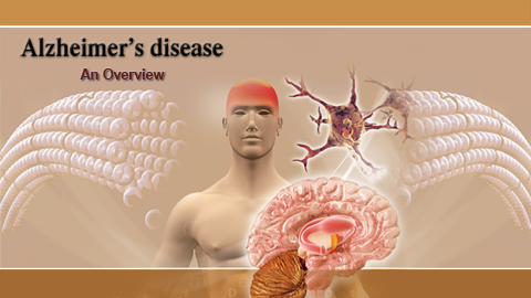 Alzheimer's Disease