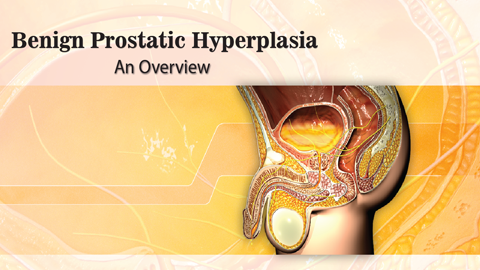 Benign Prostatic Hyperplasia (BPH)
