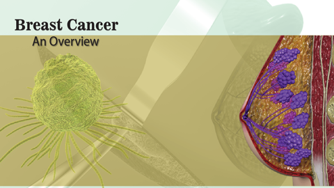 Breast cancer