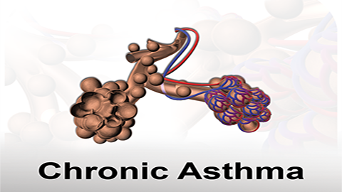 Chronic Asthma
