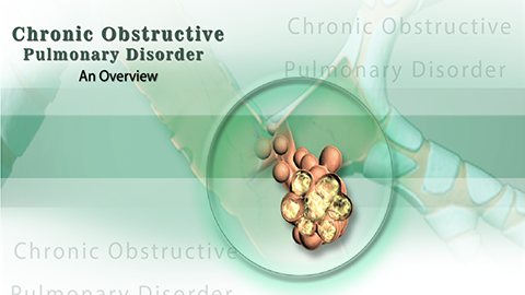Chronic Obstructive Pulmonary Disease (COPD)