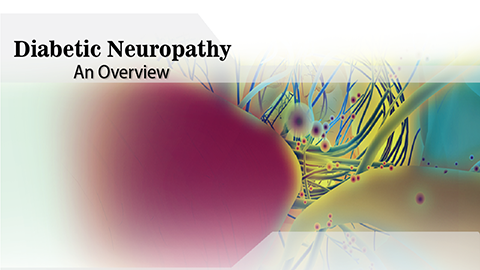 Diabetic Neuropathy