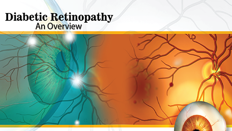 Diabetic Retinopathy