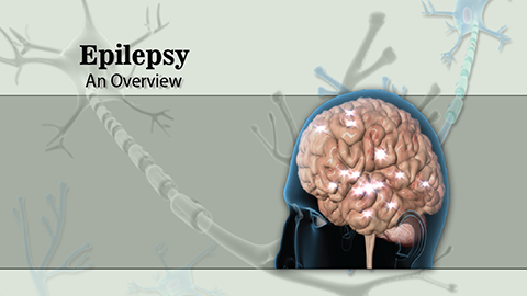 Epilepsy