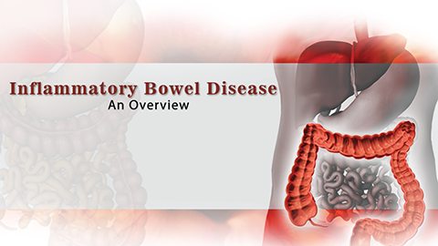 Inflammatory Bowel Disease