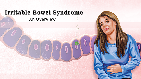 Irritable Bowel Syndrome