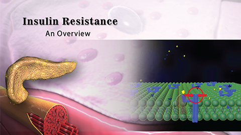Insulin Resistance