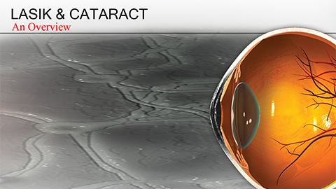 LASIK & Cataract