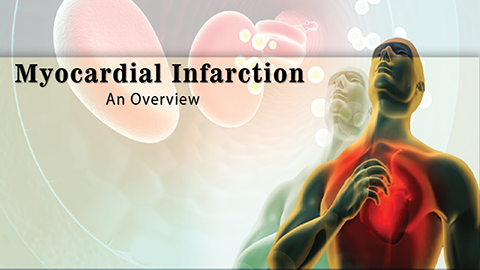 Myocardial Infarction