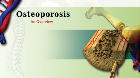 Osteoporosis