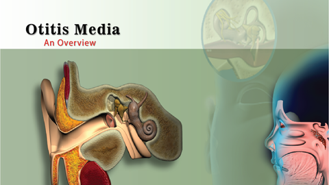 Otitis Media