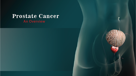 Prostate cancer
