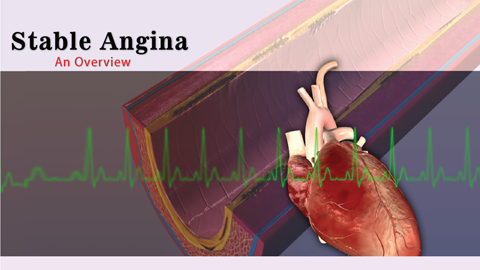 Stable Angina