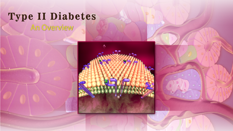 Type 2 diabetes