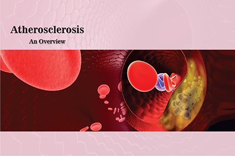 Atherosclerosis-poster